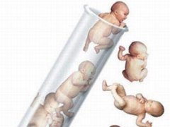 诺优笙国际：美国试管如何提高一次生双胞胎的概率？